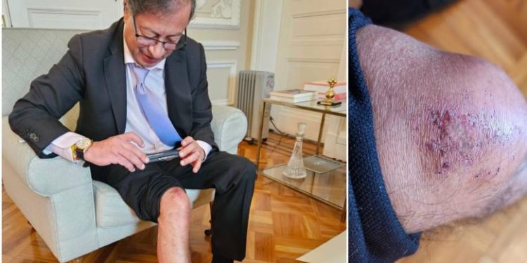 La fotografía del día «Retratando al Chocó», con la cámara 📷 oculta de Jacinto Mosquera Agualimpia